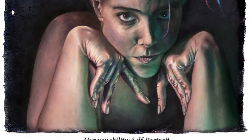 Hypermobility: Self-Portrait (by MANDEM)