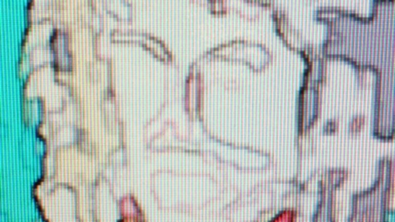 Michael Jackson's Transformation