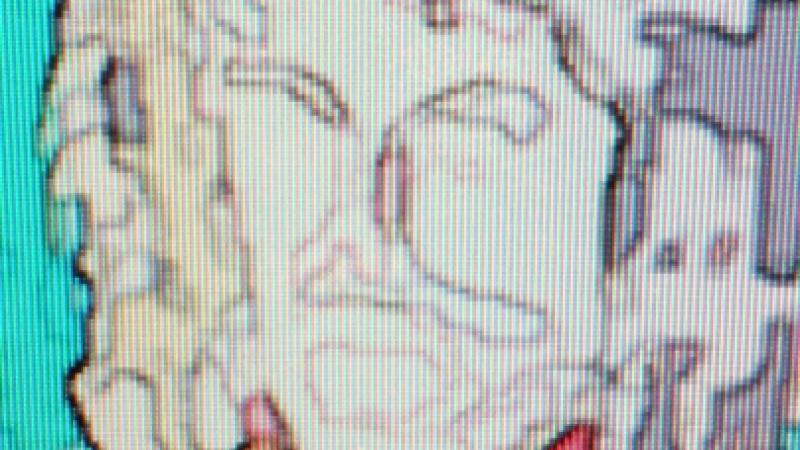 Michael Jackson's Transformation