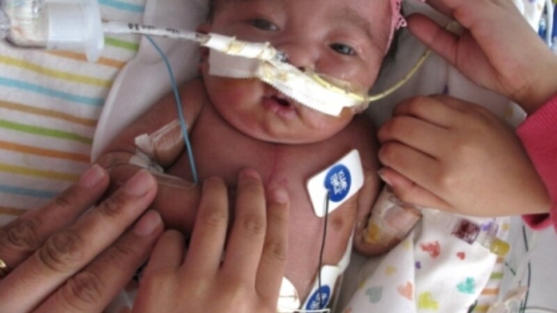 Gabriella Joy Estrada Trisomy 18