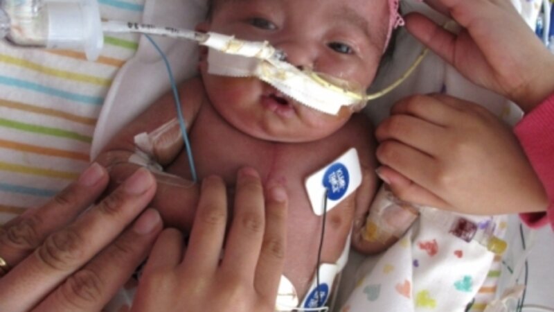 Gabriella Joy Estrada Trisomy 18