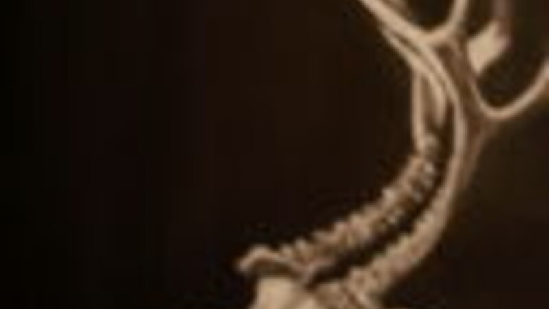 The Skull