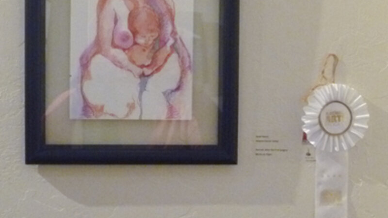 1st Annual Exhibit After the First Surgery