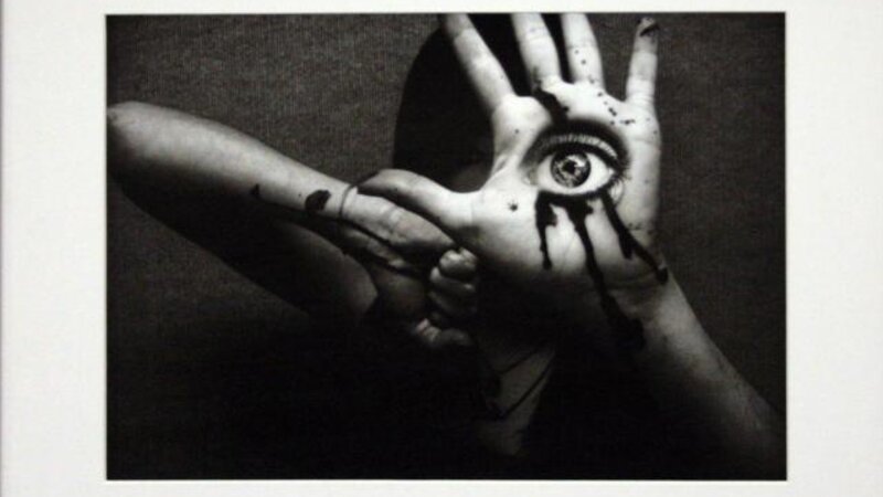 19th Annual Exhibit Ocular Displacement