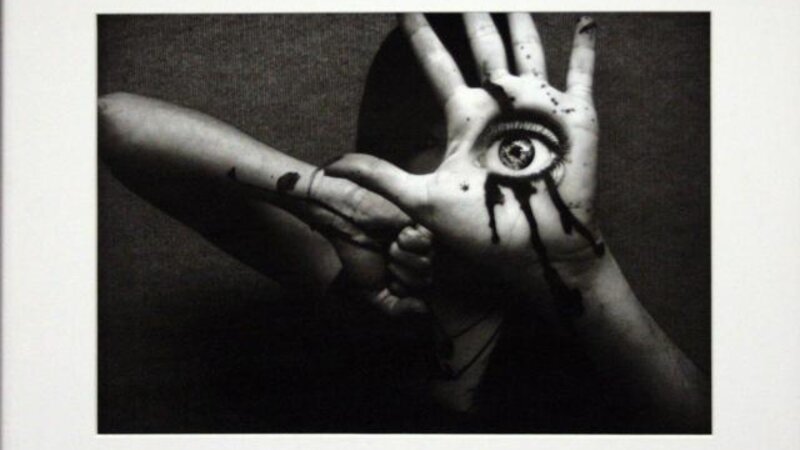 19th Annual Exhibit Ocular Displacement