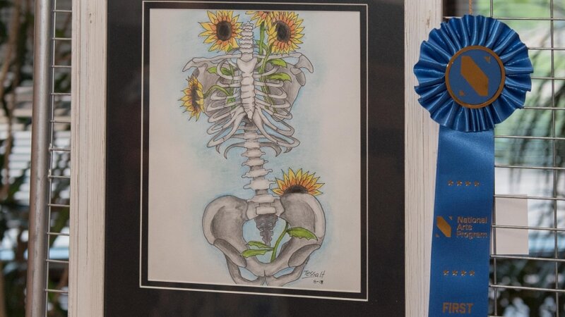 2nd Annual Exhibit Sunny Bones