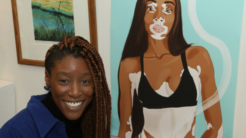 20th Annual Exhibit Winnie Harlow