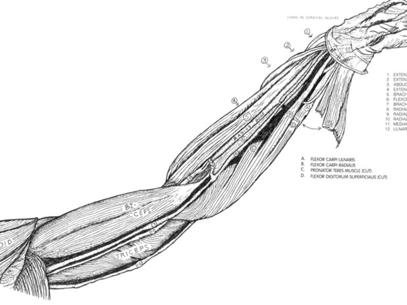 Arm Dissection, Gross Lab