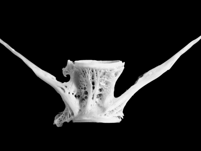 bones