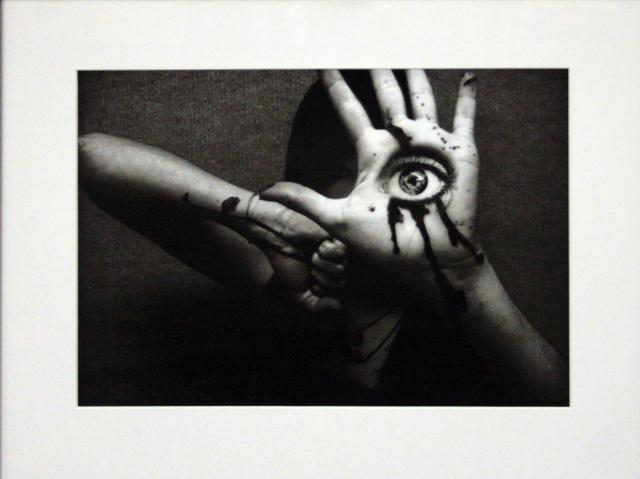 19th Annual Exhibit Ocular Displacement